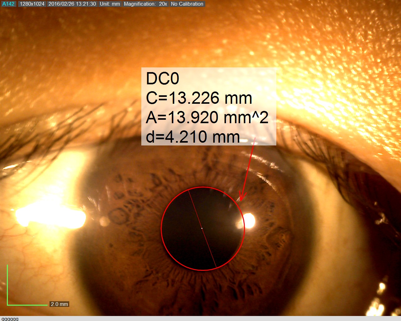 Dino-Eye with Measurement