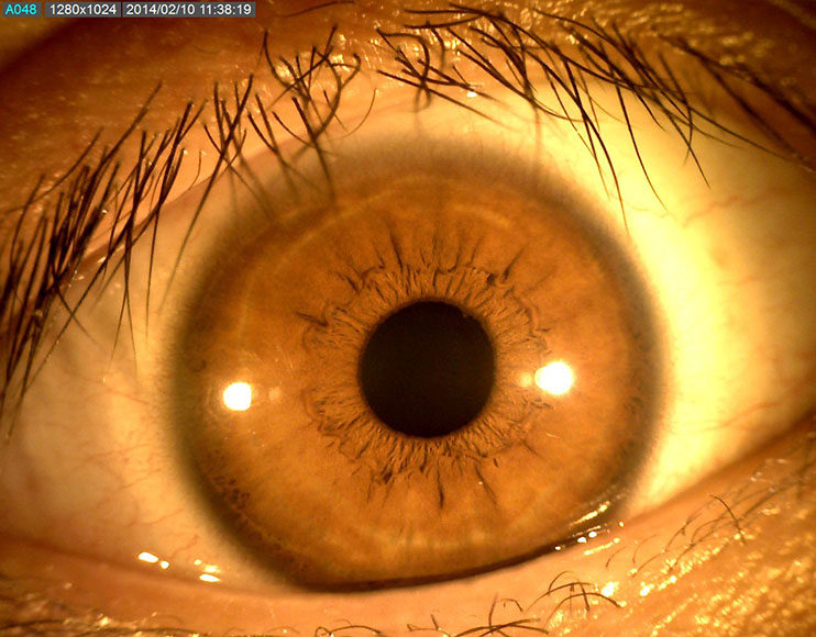 ophthalmology 02